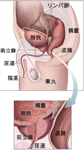 前立腺画像